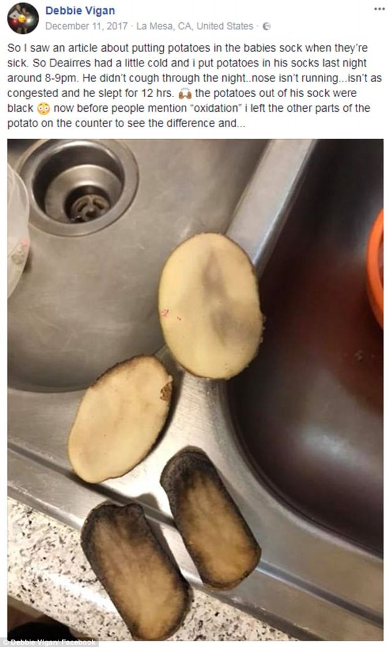 صورة البطاطس المستخدمة الغرغرة بالماء المالح تخفف ألم احتقان الحلق