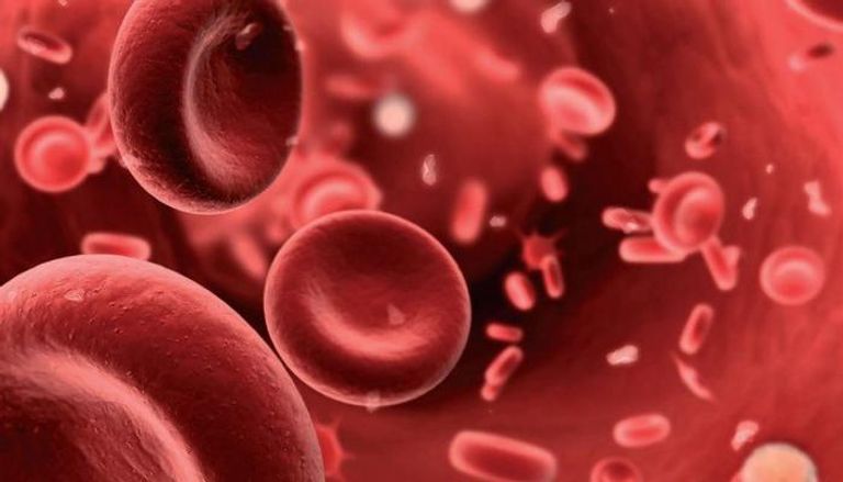 فقر الدم من أخطر الأمراض التي يسببها نقص الحديد