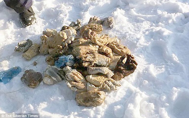 يشتبه أن تكون هذه الأيادي لجثث سُرقت أعضاؤها