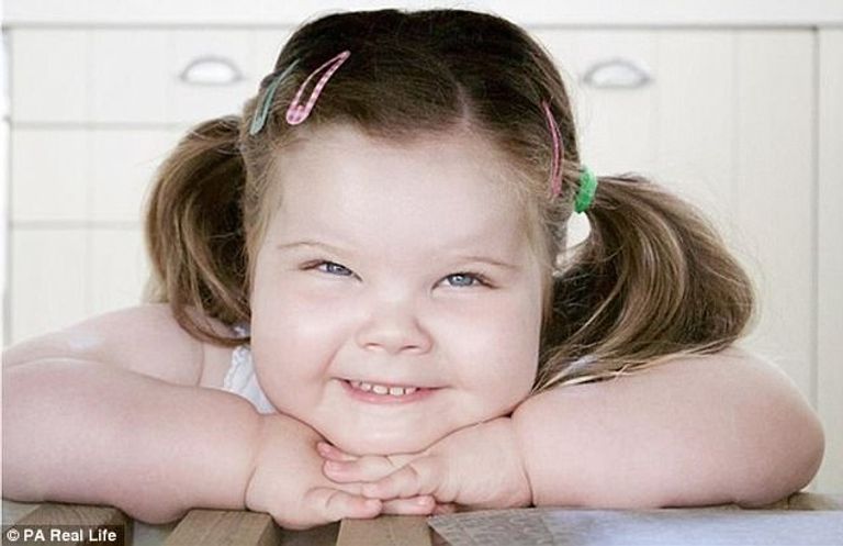 قلة النوم ترتبط بالوزن لدى الأطفال