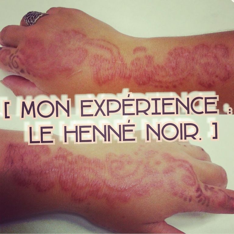 آثار الحنة القاتلة الجزائر تحذر من حناء قاتلة قادمة من ليبيا