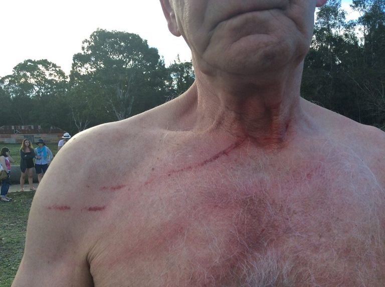 الكانجارو في أستراليا تهاجم الزوار بحثا عن المقرمشات ووجبات ماكدونالدز