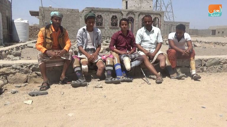 بعض ضحايا ألغام الحوثيين الإيرانية ألغام حوثية نزعها الجيش اليمني