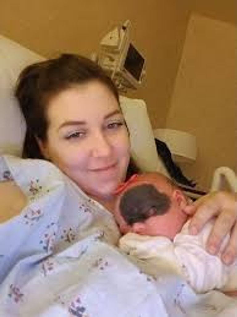 الطفلة صاحبة الوحمة