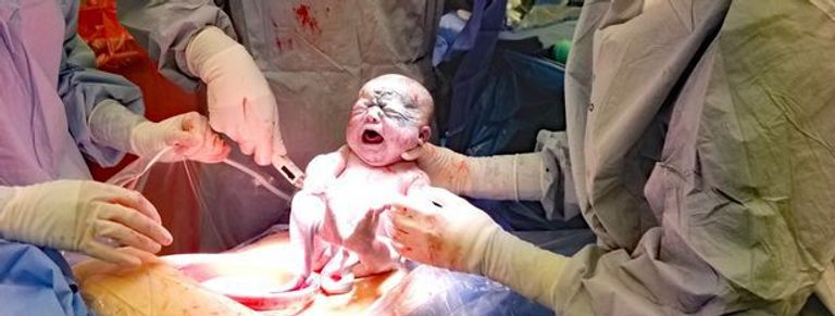 الطفلة صاحبة الوحمة