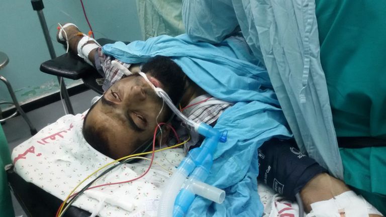 مستشفى بقطاع غزة يكافح لإغاثة المصابين