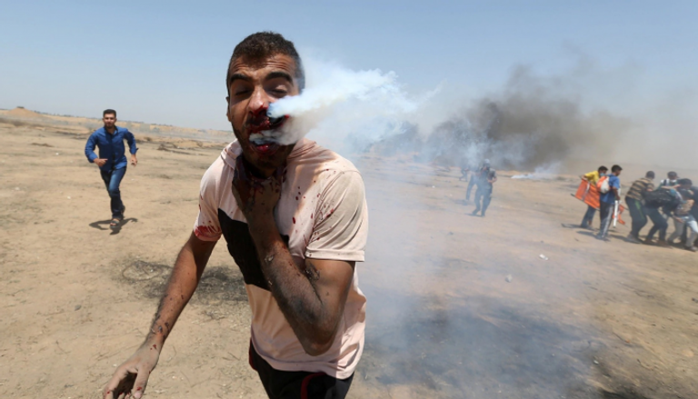 قنبلة غاز تصيب فلسطينيا في وجهه لينفث غازا ودما