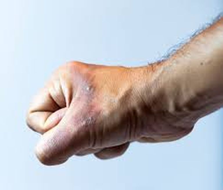 طوارئ صحية يمكنك علاجها بمفردك