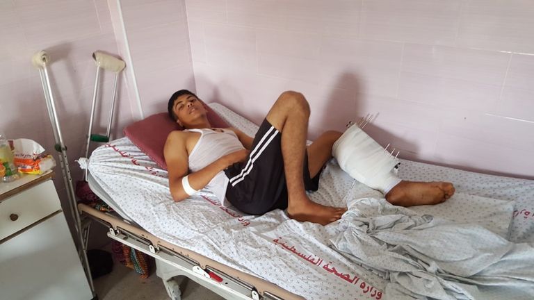 الجرحى الفلسطينيون يمضون العيد في المستشفيات قبور شهداء غزة