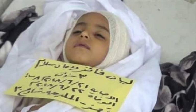 الطفلة اليمنية القتيلة ليان فائز ردمان