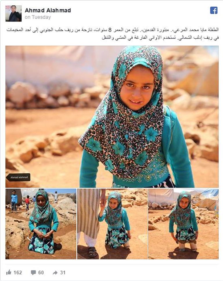 طفلة سورية تستخدم "أواني فارغة" كأطراف صناعية