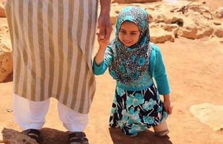 طفلة سورية تستخدم "أواني فارغة" كأطراف صناعية