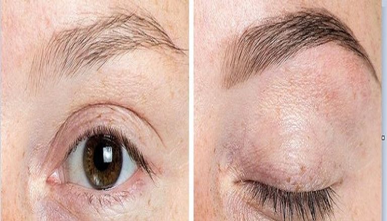 وصفات طبيعية للقضاء على مشاكل الوجه