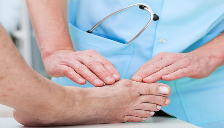 اللحوم الحمراء أول مسببات النقرس