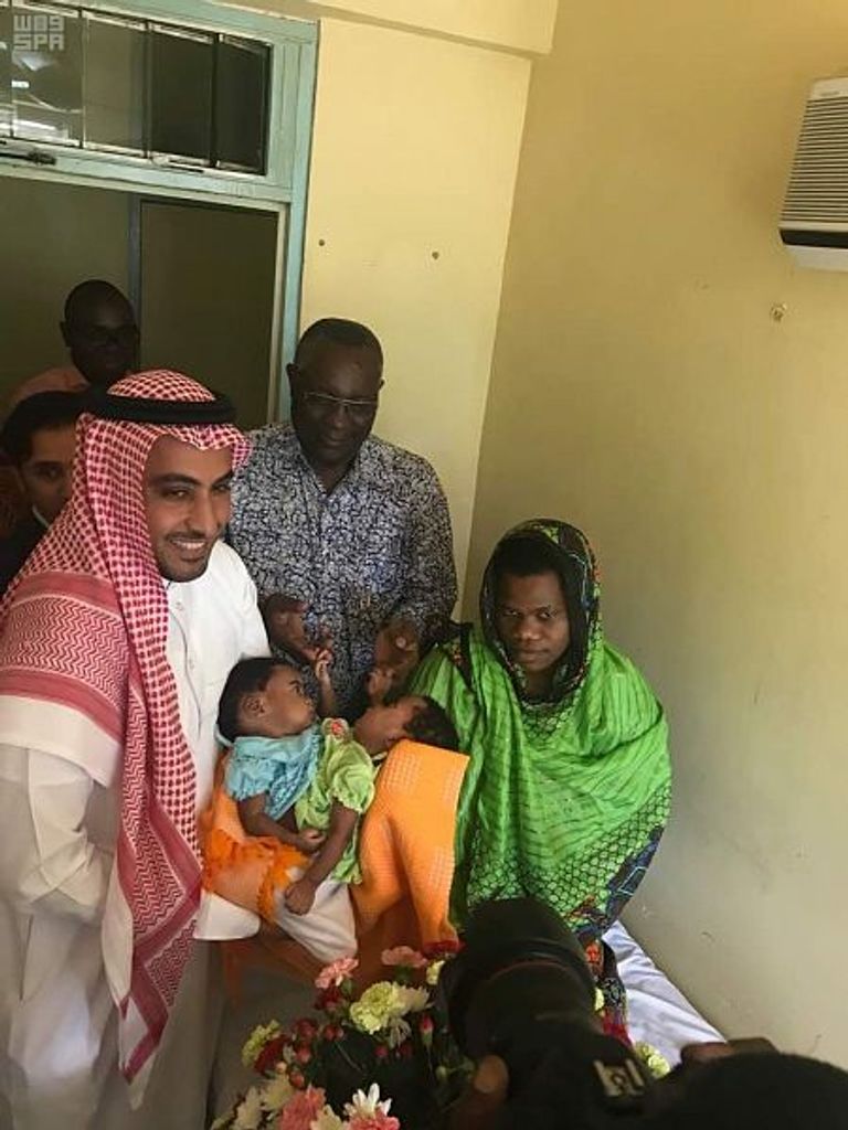 وفد السفارة السعودية في تنزانيا يزور التوأم السيامي