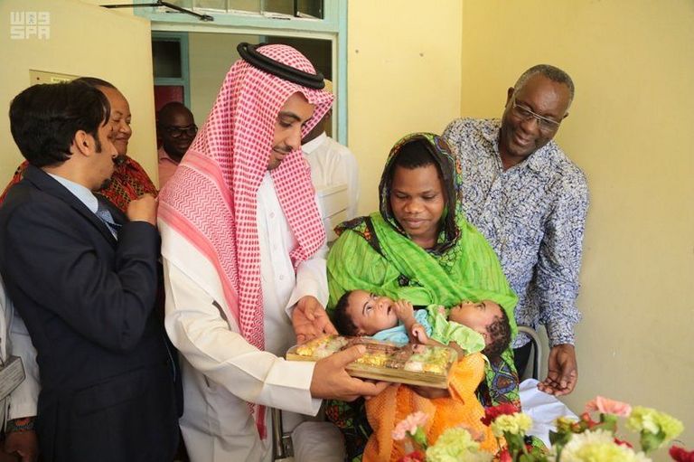 وفد السفارة السعودية في تنزانيا يزور التوأم السيامي