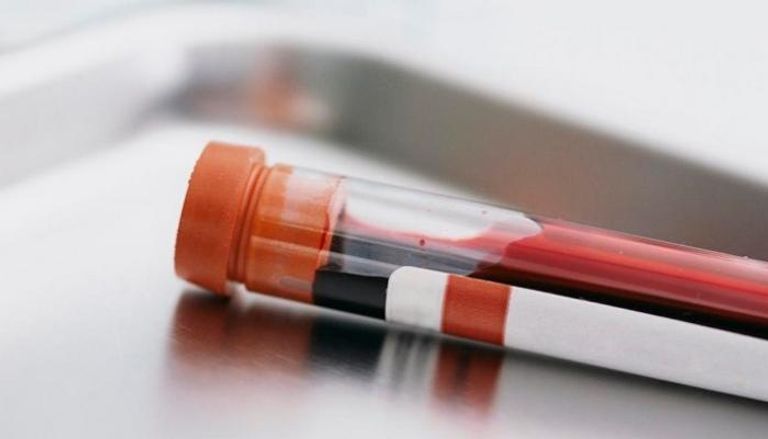 تحليل جديد للدم يتوقع العمر المتبقي للإنسان