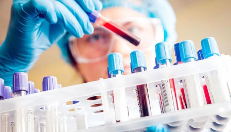 اختبار للدم يكشف خطر الوفاة بسرطان الأمعاء