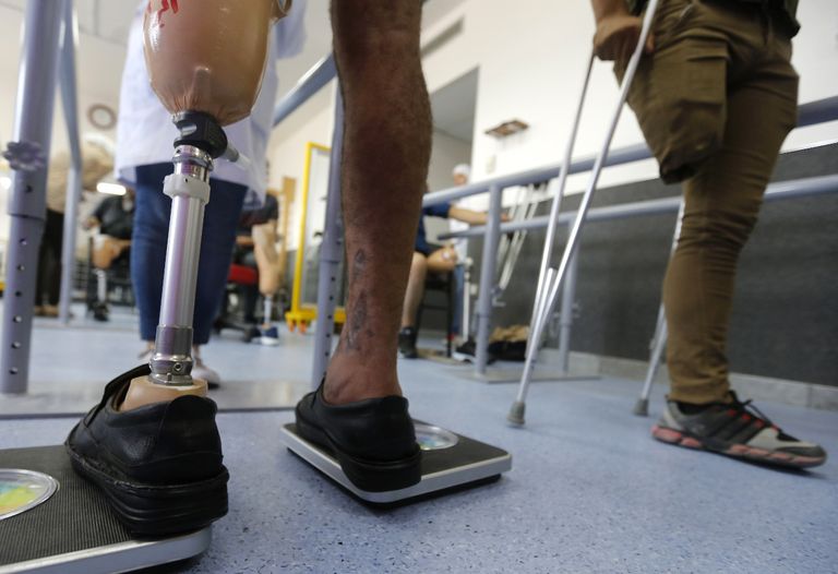 تركيب الأطراف صناعة تطورت في سوريا خلال الحرب 