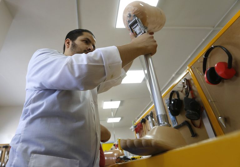 تركيب الأطراف صناعة تطورت في سوريا خلال الحرب 