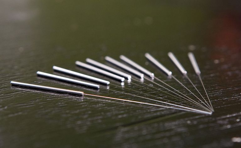 الإبر الصينية أثبتت فاعلية كبيرة في العلاج