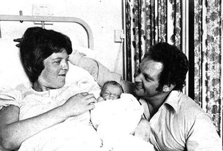 لويز براون عند ولادتها لويز براون أول طفلة في العالم تولد بتقنية التلقيح الاصطناعي