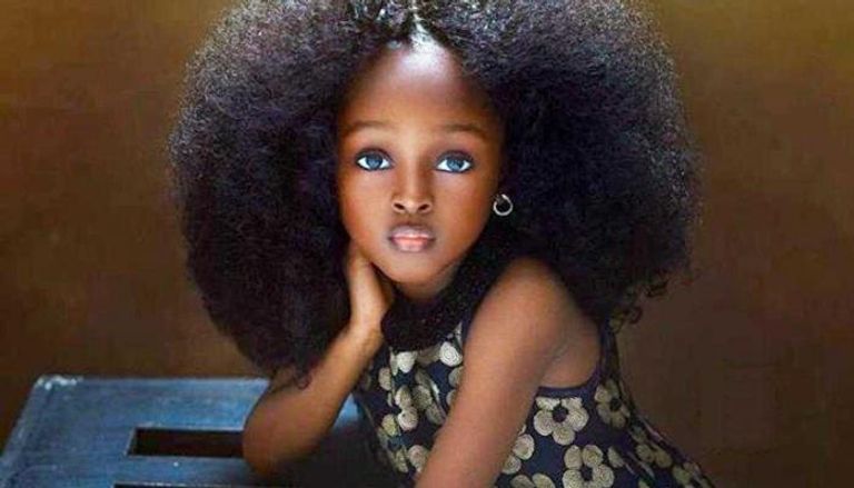 "يارا" طفلة نيجيرية تحصد لقب الأجمل في العالم