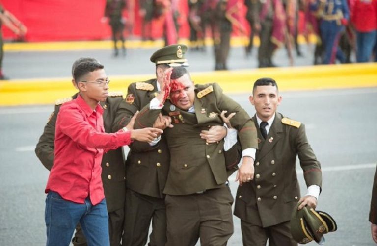 جندى مصاب بالحادث الرئيس الفنزويلي نيكولاس مادورو