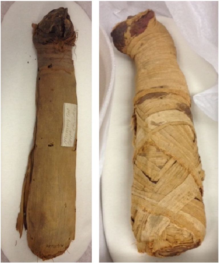 التصوير المقطعي المحوسب