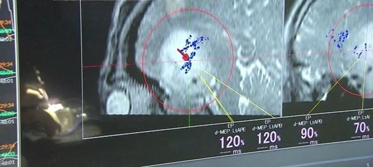 افتتاح غرفة عمليات طبية ذكية في اليابان