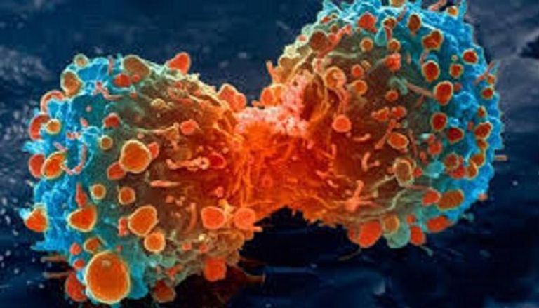 الكشف المبكر يساعد في القضاء على الخلايا السرطانية