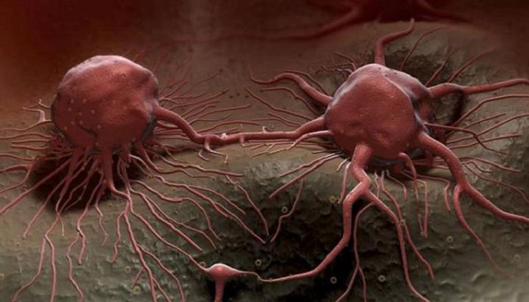 خلايا سرطانية - صورة أرشيفية