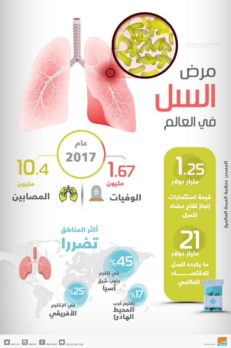 ثلث سكان العالم مصابون بالسل الكامن