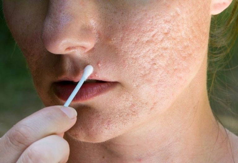 تلميع الخواتم ضمن استخدامات معجون الأسنان