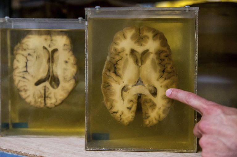 الكتاب يؤكد أن  الذكاء ليس هبةً تُمنح عند الولادة 