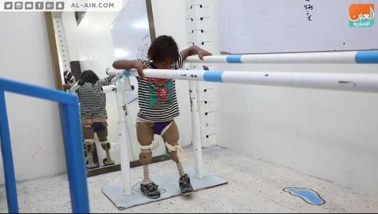 الطفل اليمني عماد الذي فقد ساقيه بسبب ألغام الحوثي