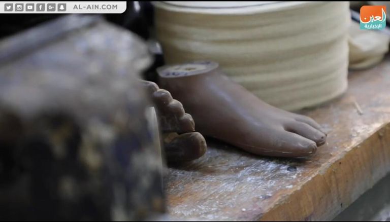 الطفل اليمني عماد الذي فقد ساقيه بسبب ألغام الحوثي