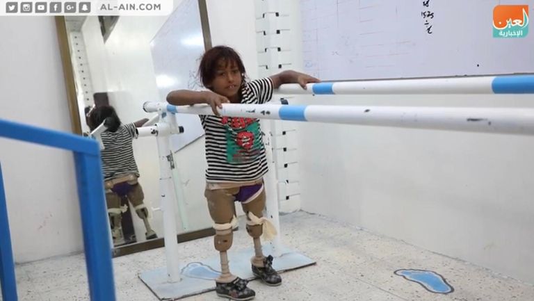 الطفل اليمني عماد الذي فقد ساقيه بسبب ألغام الحوثي