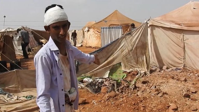 جريمة حوثية جديدة تستهدف النازحين في حرض بني الحداد في حرض اليمنية بعد تهجيرهم قسريا