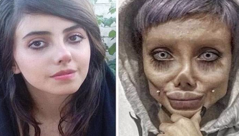 الفتاة فاطمة المعروفة باسم "سحر طبر" قبل وبعد العمليات التجميلية
