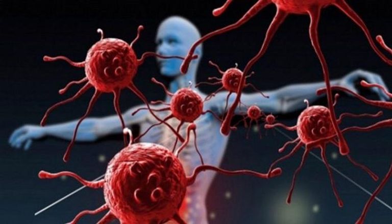 سرطان الثدي يفتك بأكثر من نصف مليون شخص سنويا