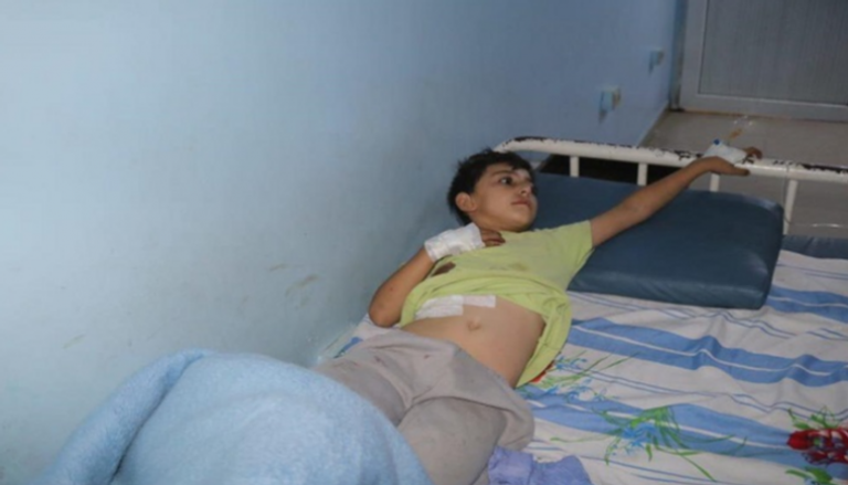 الطفل السوري المصاب جراء العدوان التركي