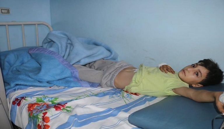 الطفل السوري المصاب جراء العدوان التركي