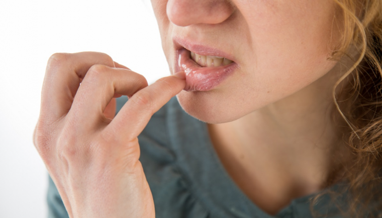 الاهتمام بنظافة الفم والأسنان يمنع الإصابة بقرحة الفم