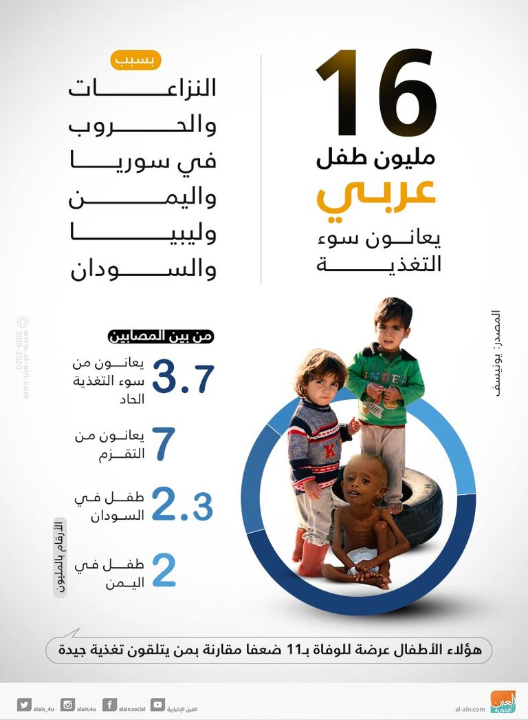 16 مليون طفل عربي يعانون سوء التغذية