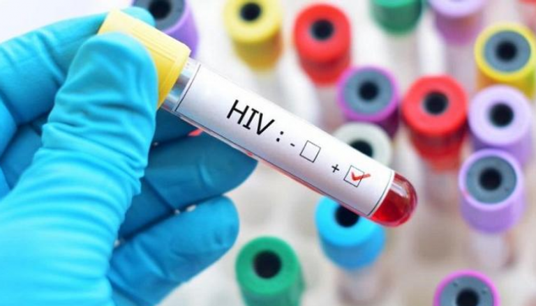 العلماء ما زالوا يبحثون عن علاج فعال ضد الإيدز