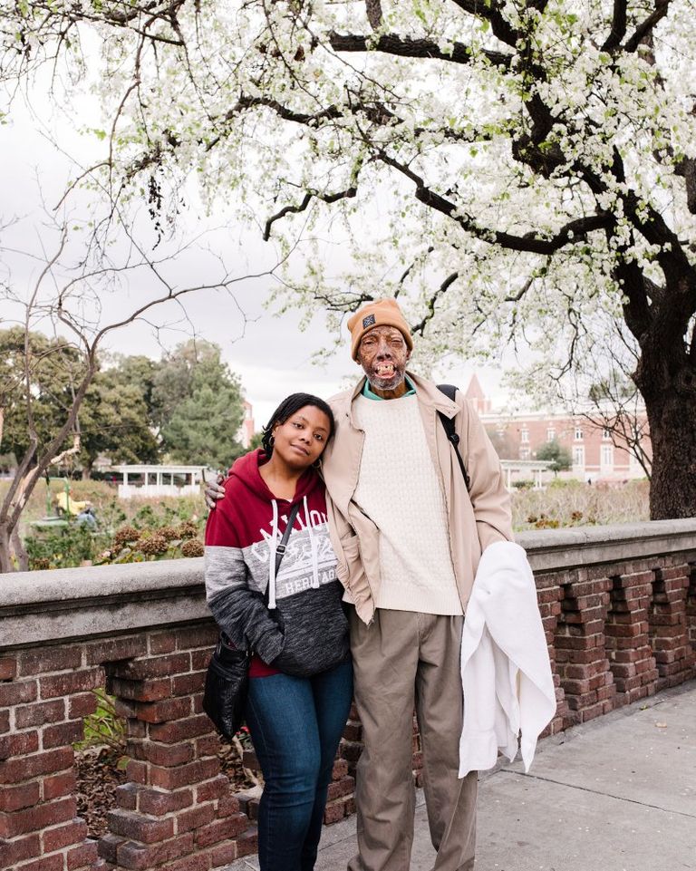 روبرت تشيلسيا أول أمريكي من أصل أفريقي يجري عملية زراعة وجه