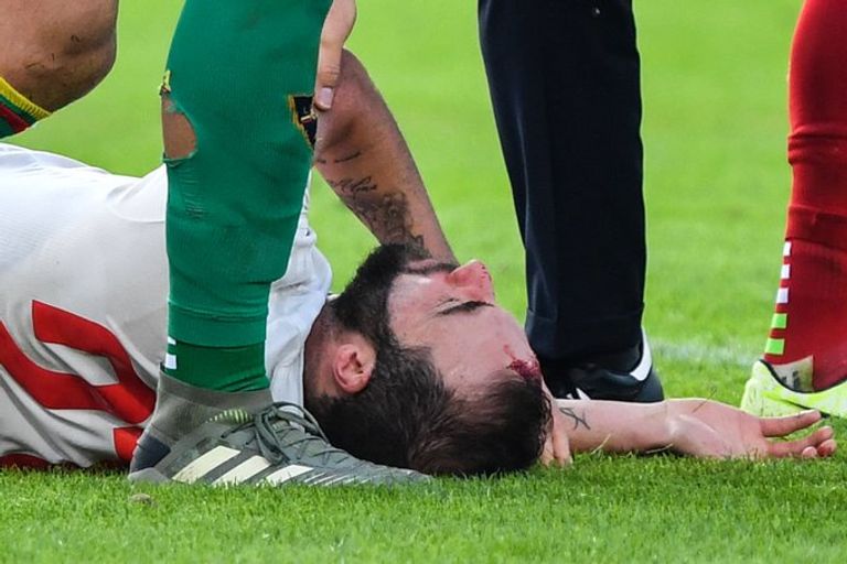 جونزالو هيجوايين مهاجم يوفنتوس