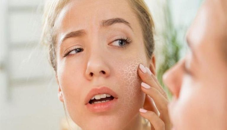 جفاف البشرة قد يشير إلى الإصابة بأحد الأمراض الجلدية