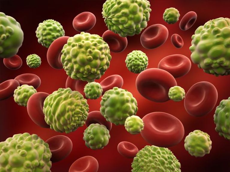 تقنية جديدة للقضاء على السرطان